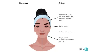 Ozempic face before and after